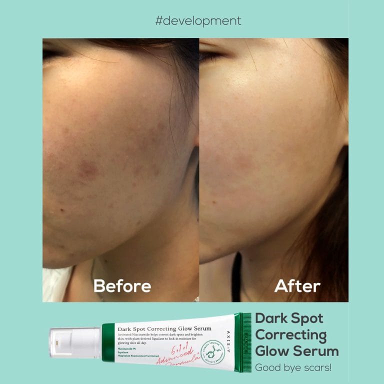 axis-y-dark-spot-correcting-glow-serum-9